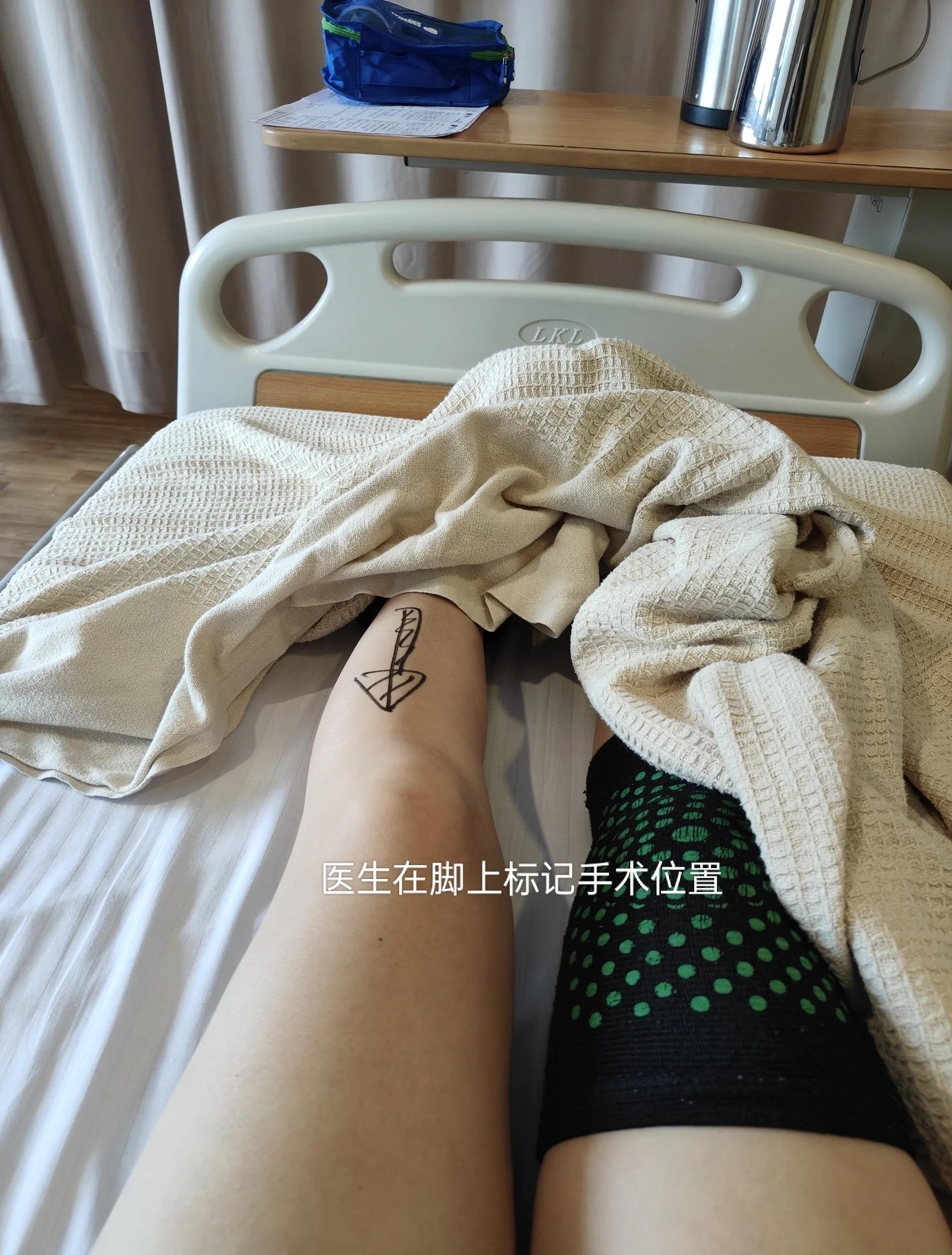 包含乔治近期训练受伤已接受左膝关节镜手术的词条